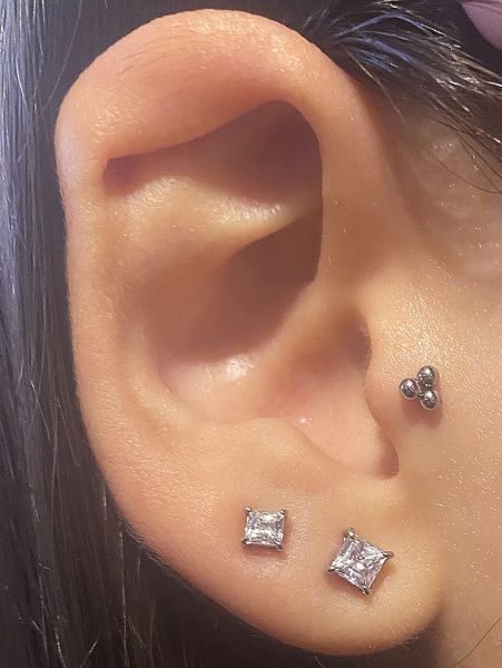 INTERNALLY THREADED LIP PIERCING WITH 3 BALLS